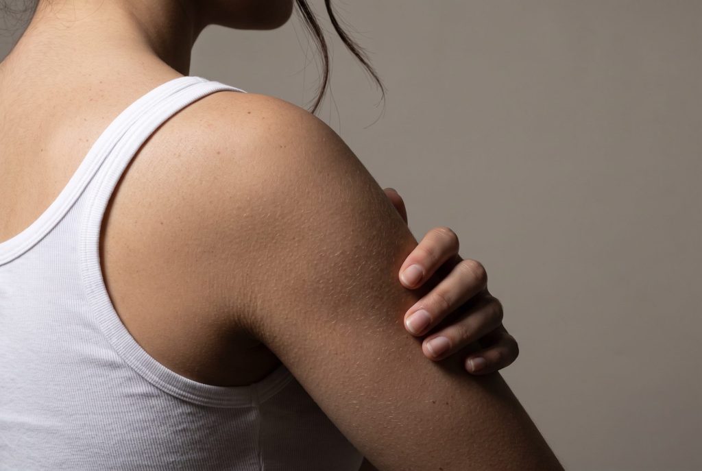 Fingertips rest on the back of a woman's upper arm, side light showing the skin's fine texture and hairs