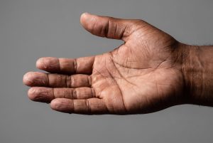 A wet open palm with fingertips wrinkled from a long soak, against a grey background