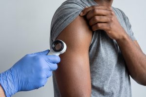 A clinician in a blue glove holds a dermatoscope to a patient's upper arm as he lifts his T-shirt sleeve