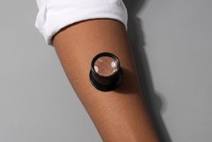 A jeweler's loupe stands on a bare forearm, its lens showing the skin's pores and fine hairs magnified